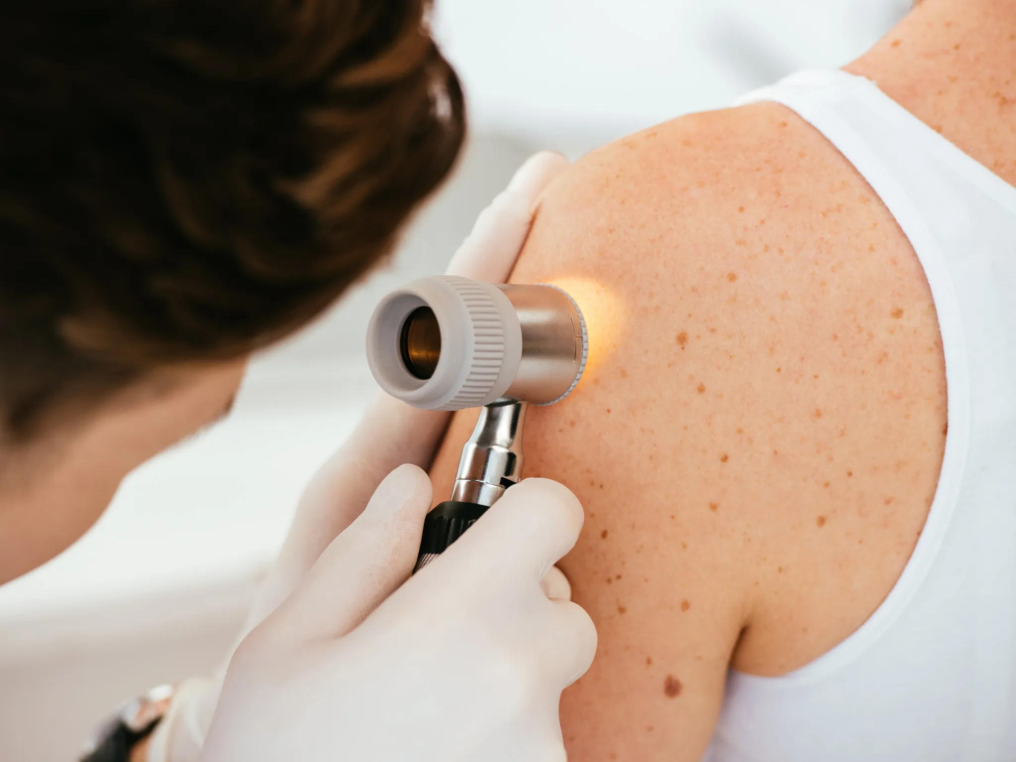 Dermatology